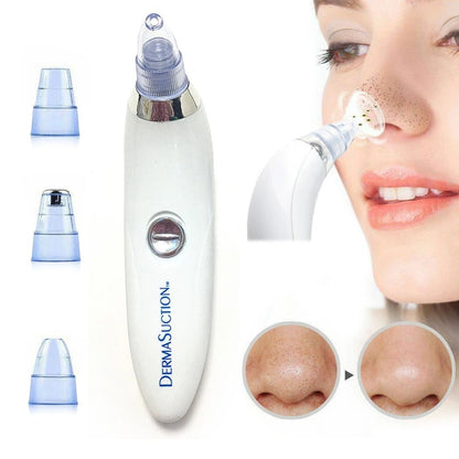Blackhead removal derma